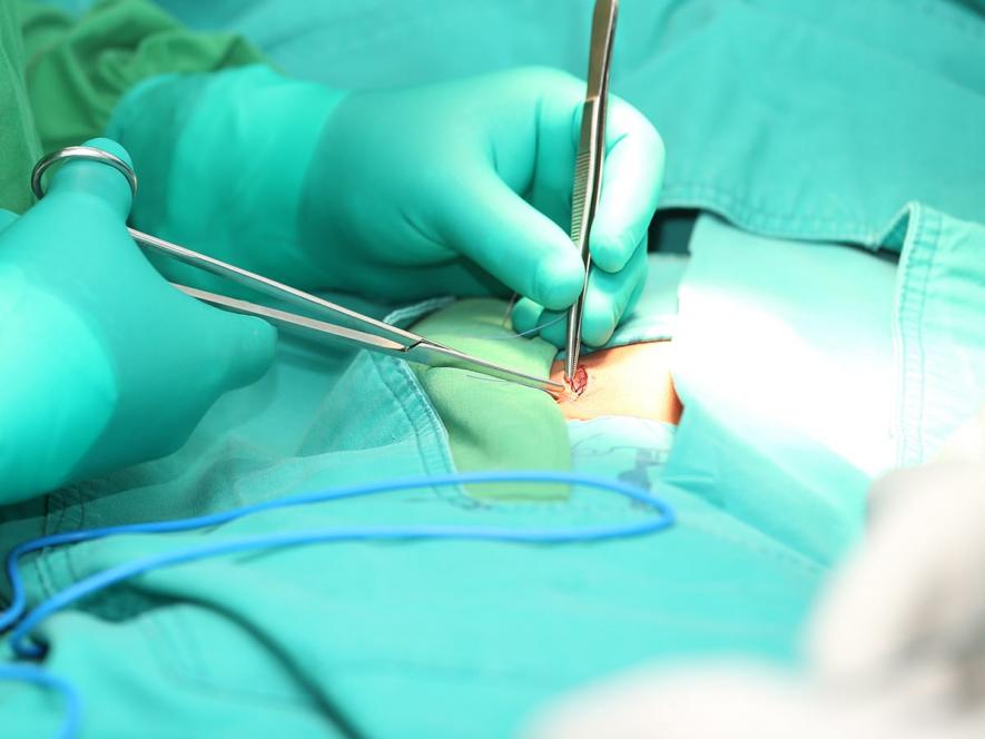 Surgical team performing open hernia repair surgery